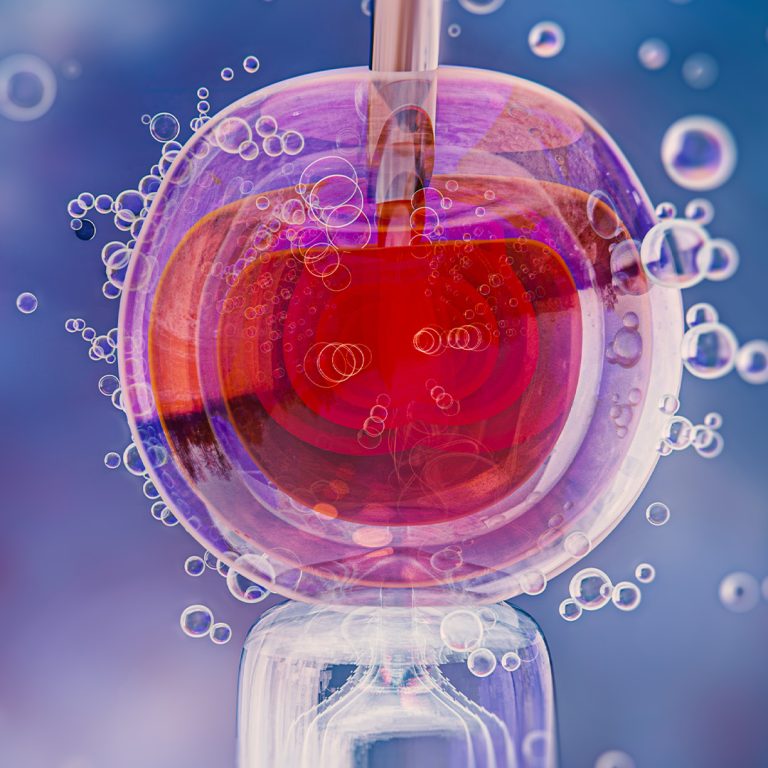 tup-bebek-ivf-tedavisi-nedir-kimlere-uygulanir-ve-basari-orani-nasildir